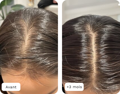 Gummies à la biotine pour des cheveux plus forts, plus denses, dès le premier mois.