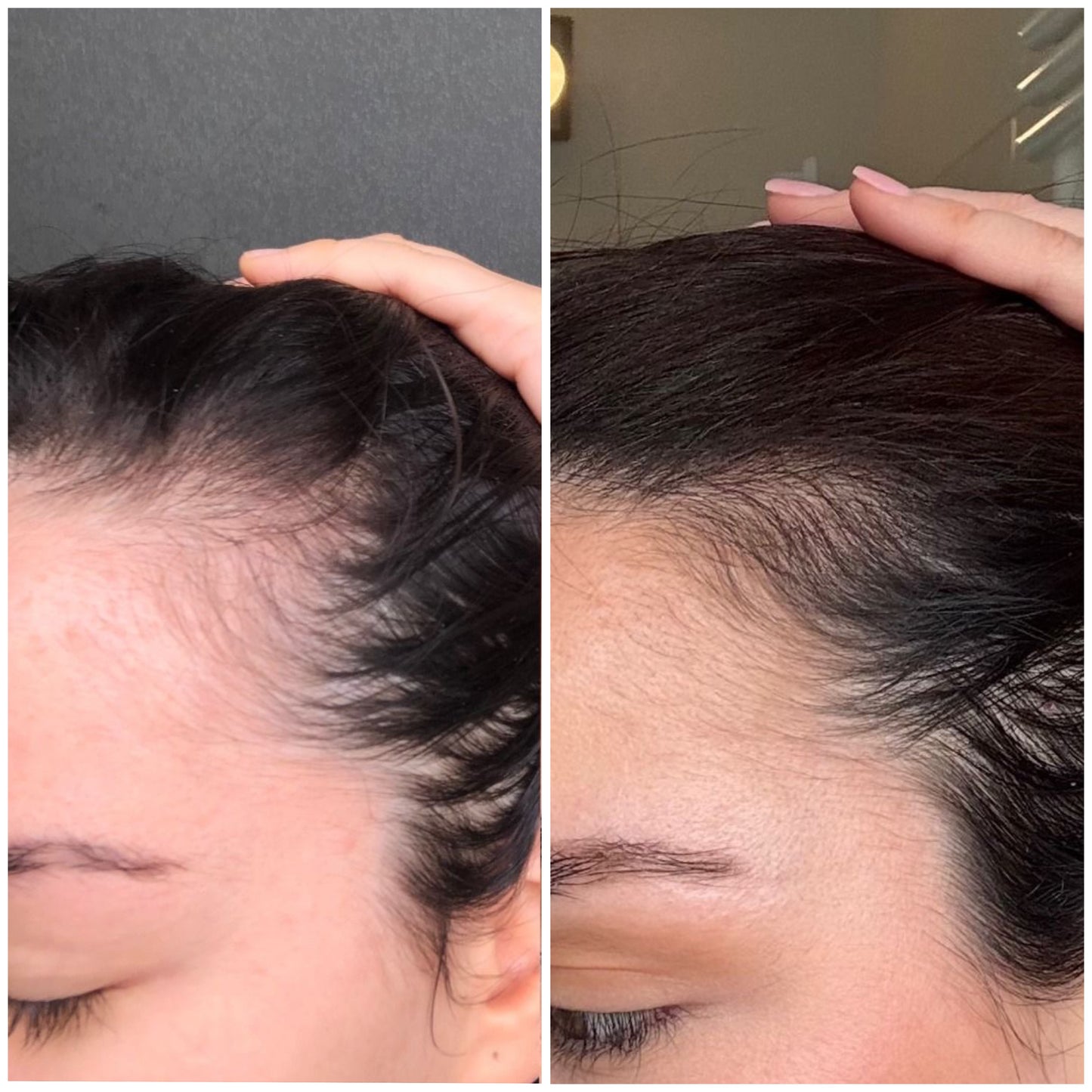 Gummies à la biotine pour des cheveux plus forts, plus denses, dès le premier mois.