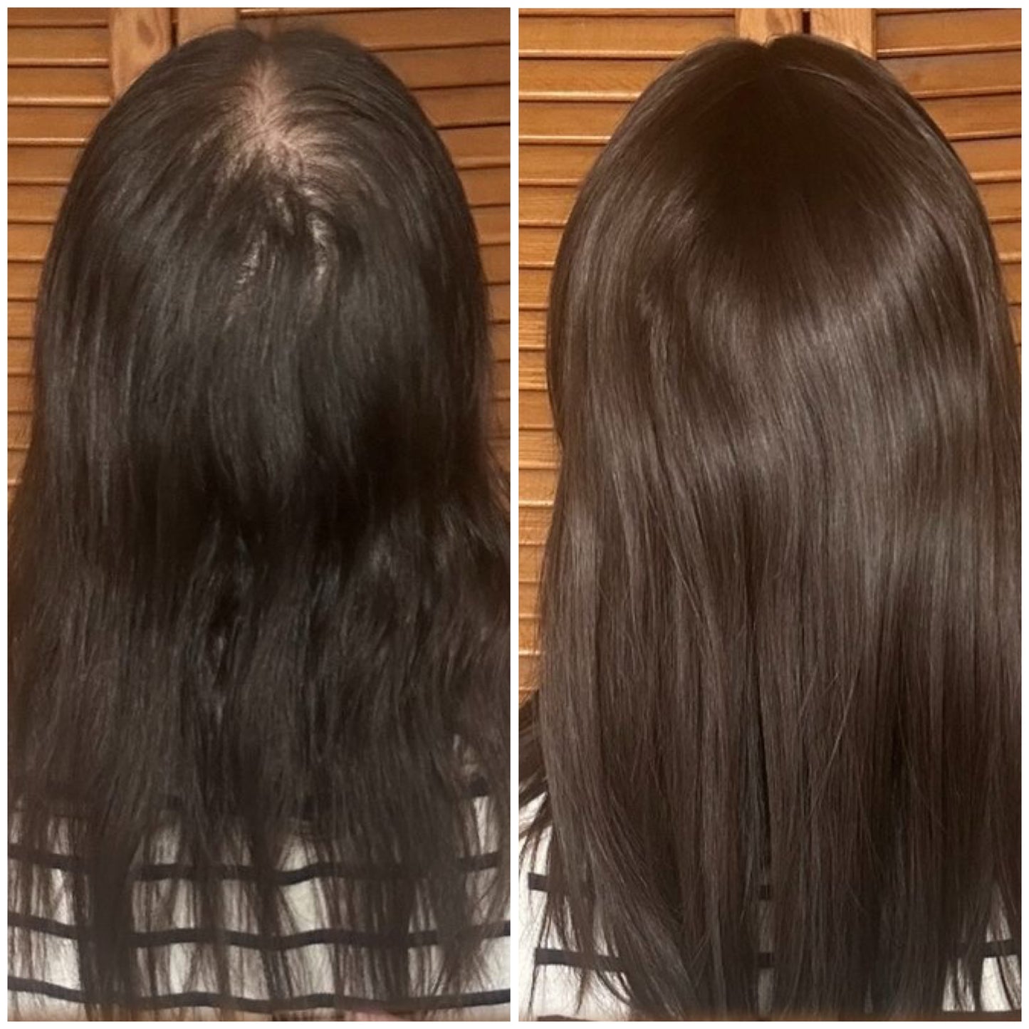 Gummies à la biotine pour des cheveux plus forts, plus denses, dès le premier mois.